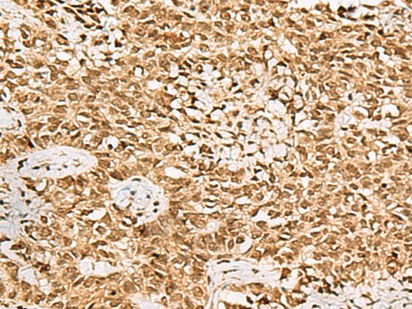 LRRC2 Polyclonal Antibody (E-AB-52349)