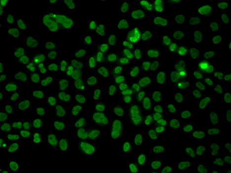 PLCXD2 Polyclonal Antibody (E-AB-66231)