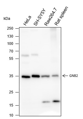 Recombinant GNB2 Monoclonal Antibody (AN301535L)
