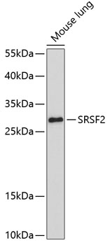 SRSF2 Polyclonal Antibody (E-AB-67585)
