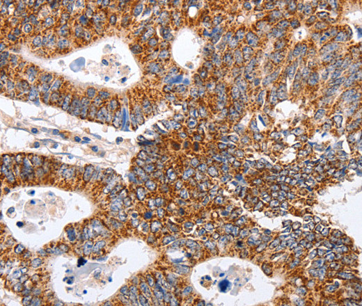 MAP2K5 Polyclonal Antibody (E-AB-10512)