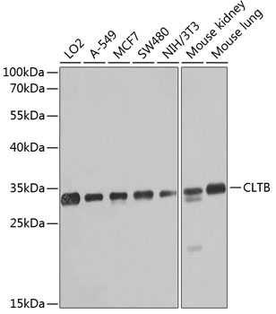 CLTB Polyclonal Antibody (E-AB-62047)