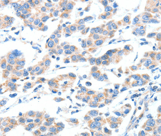 XBP1 Polyclonal Antibody (E-AB-14437)
