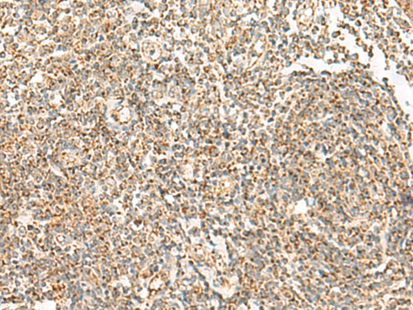 ORC4 Polyclonal Antibody (E-AB-52717)