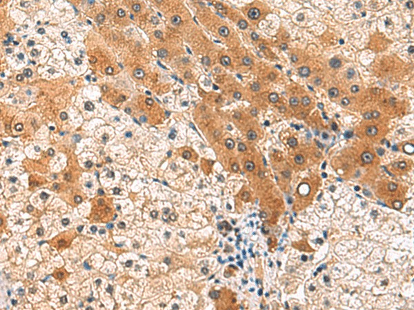 PCYT2 Polyclonal Antibody (E-AB-52929)