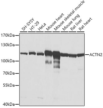 ACTN2 Polyclonal Antibody (E-AB-61999)