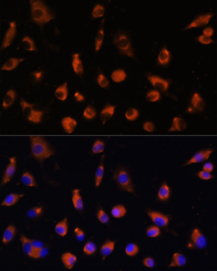 TMEM25 Polyclonal Antibody (E-AB-64990)