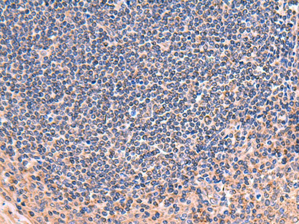 ZNF256 Polyclonal Antibody (E-AB-52971)