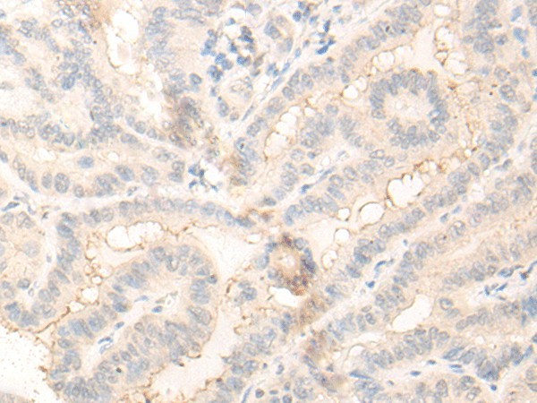 RADIL Polyclonal Antibody (E-AB-52615)