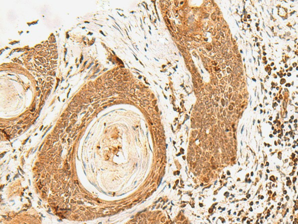 POLH Polyclonal Antibody (E-AB-18829)