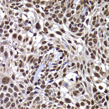 DNAJB6 Polyclonal Antibody (E-AB-61492)