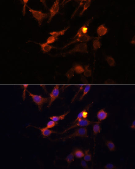 PINK1 Polyclonal Antibody (E-AB-67825)