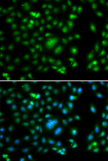 ELF5 Polyclonal Antibody (E-AB-61568)