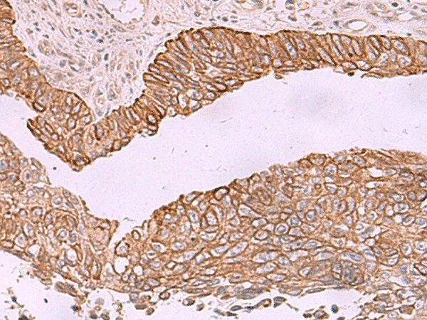 KCNK12 Polyclonal Antibody (E-AB-18166)