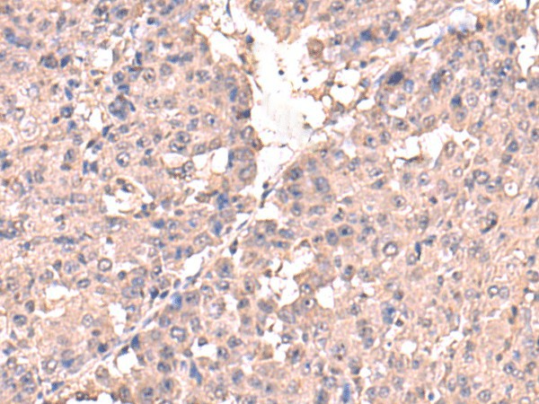 HPN Polyclonal Antibody (E-AB-18265)