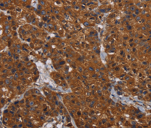 HYAL2 Polyclonal Antibody (E-AB-11315)
