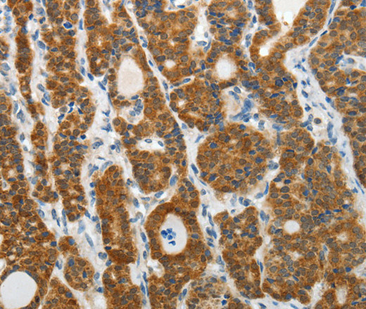 PRDX5 Polyclonal Antibody (E-AB-10557)