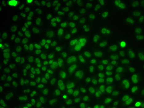 CSNK2A2 Polyclonal Antibody (E-AB-60372)