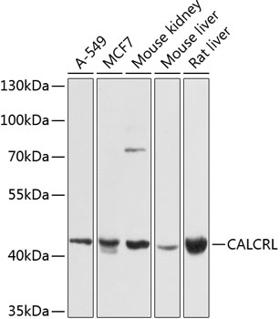 CALCRL Polyclonal Antibody (E-AB-63022)