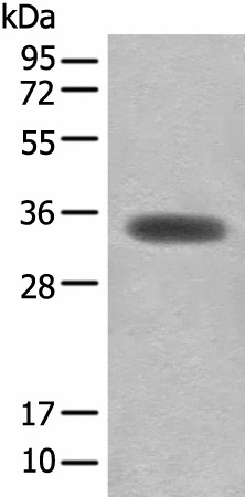 MYOZ2 Polyclonal Antibody (E-AB-52584)