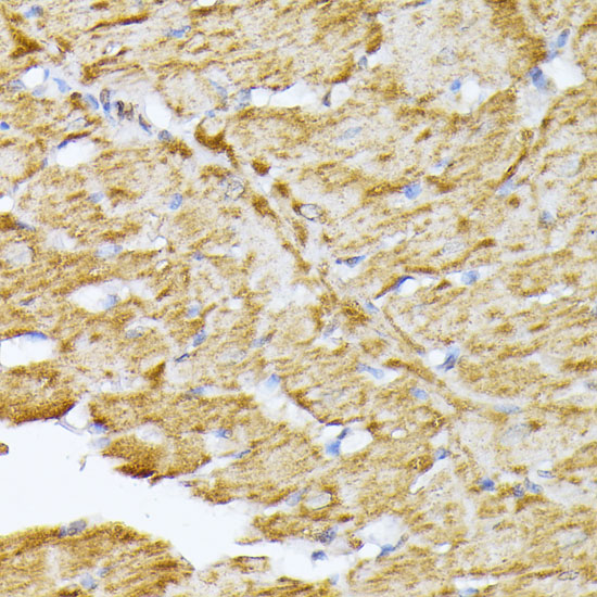 SLC25A5 Polyclonal Antibody (E-AB-66515)