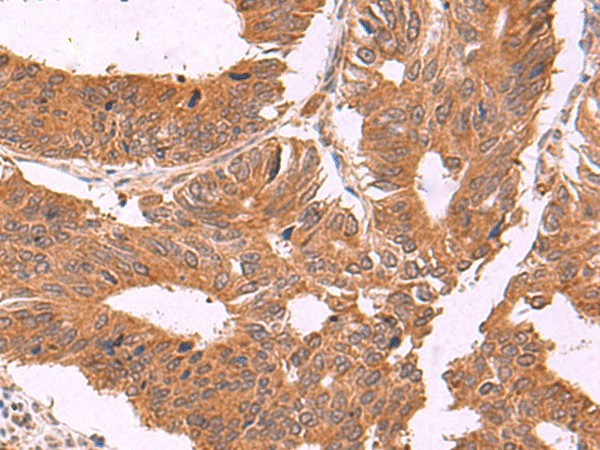ZBTB33 Polyclonal Antibody (E-AB-52062)