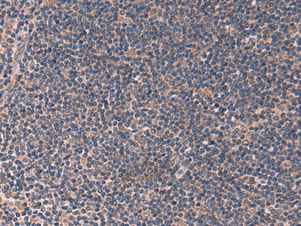 ITPR2 Polyclonal Antibody (E-AB-52051)