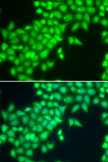 METTL2A Polyclonal Antibody (E-AB-66233)