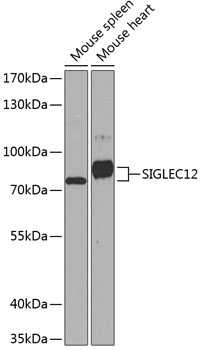 SIGLEC12 Polyclonal Antibody (E-AB-63194)