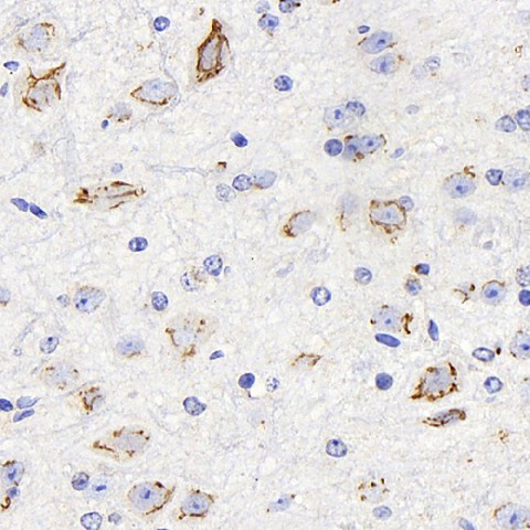 DLL1 Polyclonal Antibody (E-AB-70187)
