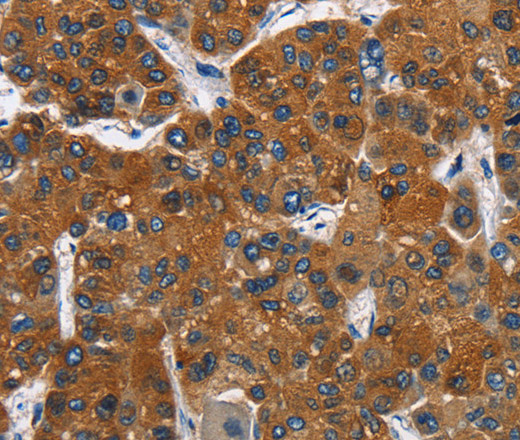 CATSPER3 Polyclonal Antibody (E-AB-11037)