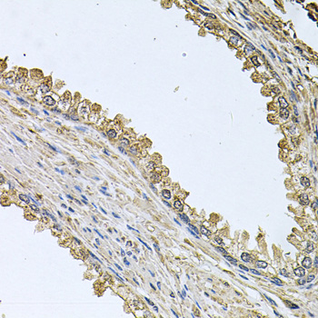 MEMO1 Polyclonal Antibody (E-AB-63109)