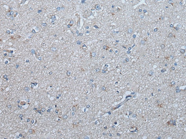 UBR4 Polyclonal Antibody (E-AB-53573)