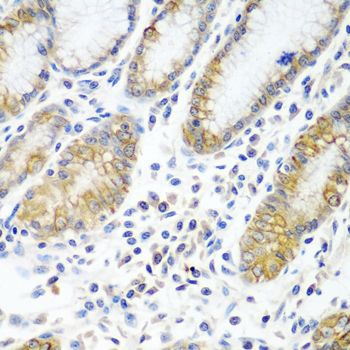 ATAD3A Polyclonal Antibody (E-AB-62473)