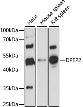 DPEP2 Polyclonal Antibody (E-AB-91182)