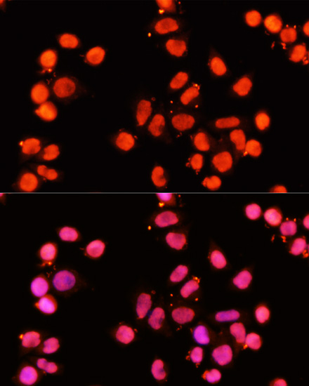 XRCC1 Polyclonal Antibody (E-AB-64012)
