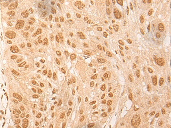 DBP Polyclonal Antibody (E-AB-17882)