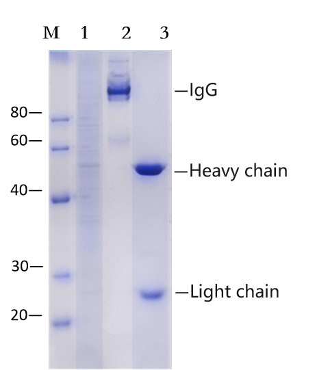 Protein A agarose gel (EA-IP-015)