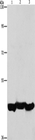 PGK1 Polyclonal Antibody (E-AB-10949)