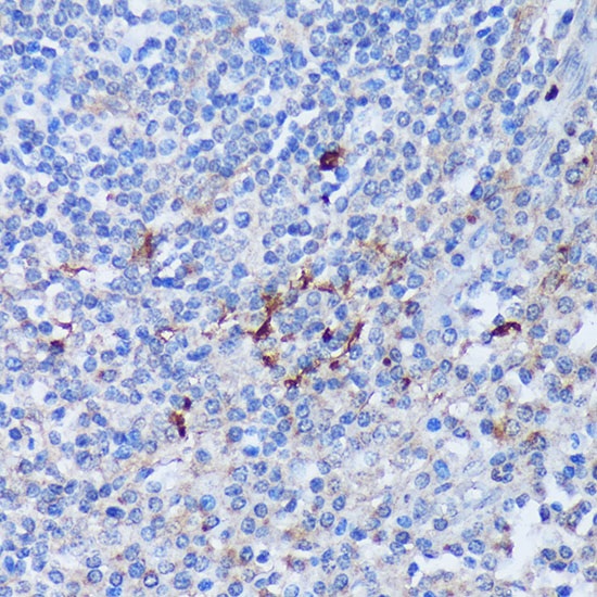 PADI4 Polyclonal Antibody (E-AB-66716)
