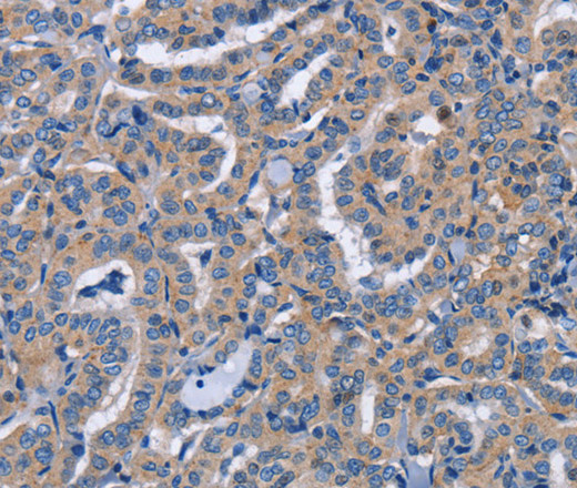 NCR2 Polyclonal Antibody (E-AB-13122)