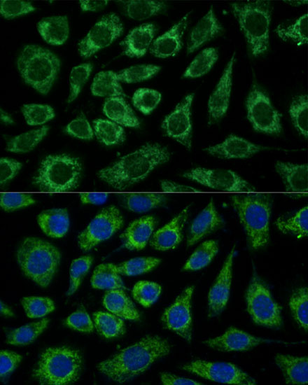 NDUFA4 Polyclonal Antibody (E-AB-66538)
