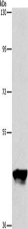 PIP4K2A Polyclonal Antibody (E-AB-10953)