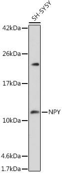 NPY Polyclonal Antibody (E-AB-93379)