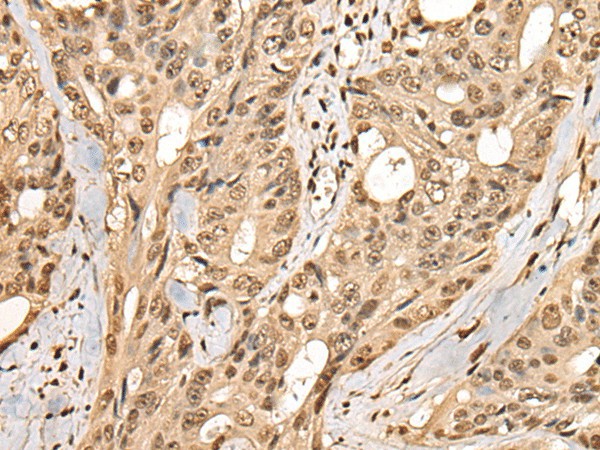 PHF21A Polyclonal Antibody (E-AB-52472)