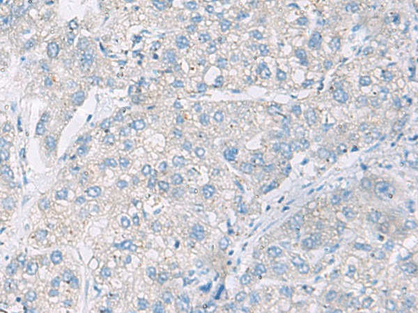 DACT3 Polyclonal Antibody (E-AB-52569)
