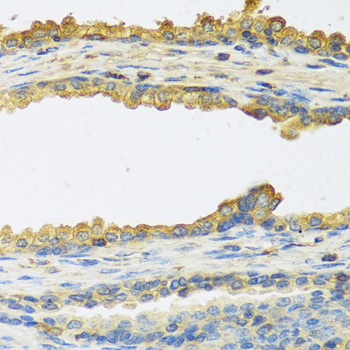 TSHB Polyclonal Antibody (E-AB-61360)