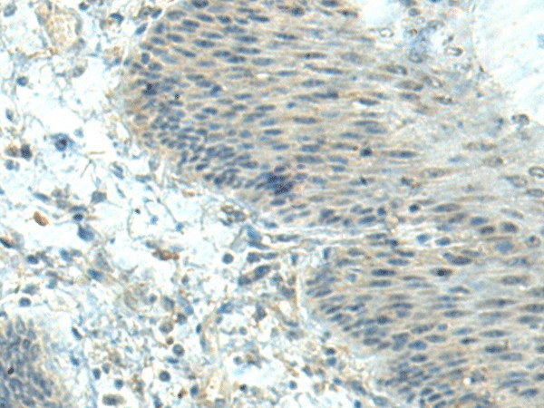 CTDP1 Polyclonal Antibody (E-AB-19860)