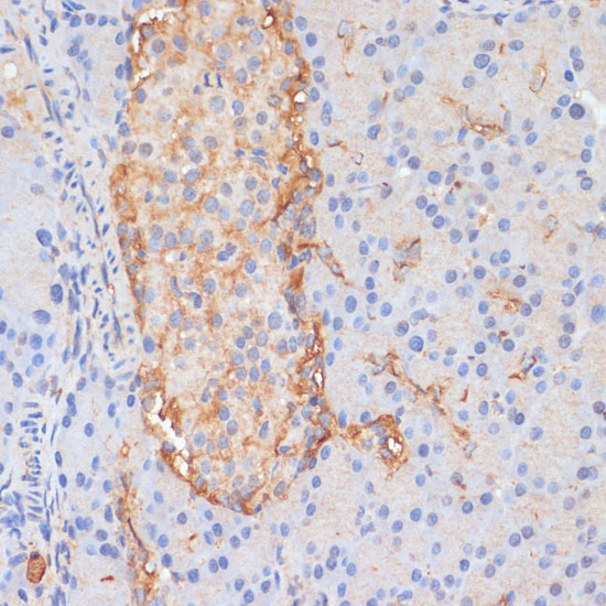 DLL1 Polyclonal Antibody (E-AB-66262)