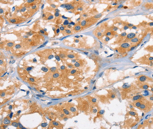 AHR Polyclonal Antibody (E-AB-13060)